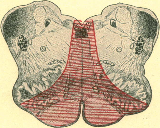 Fig. 11