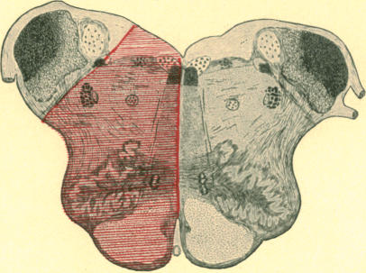 Fig. 17