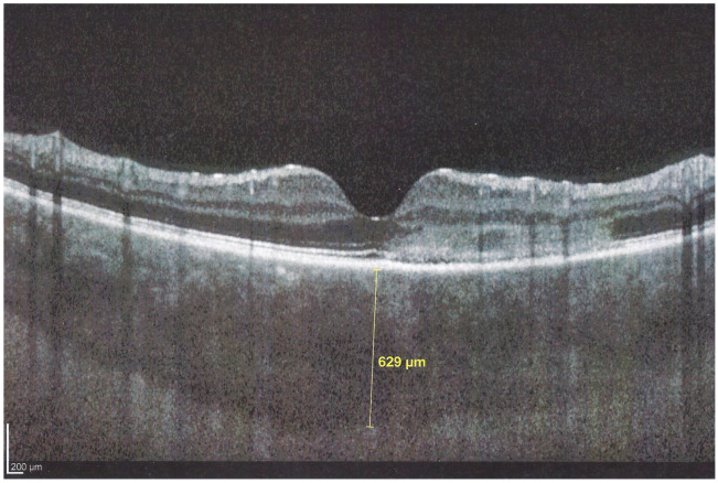 Figure 11