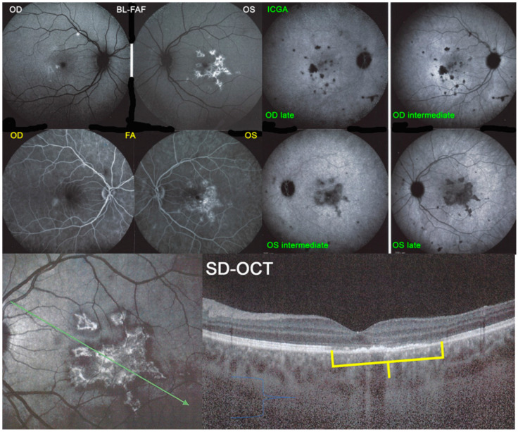 Figure 24