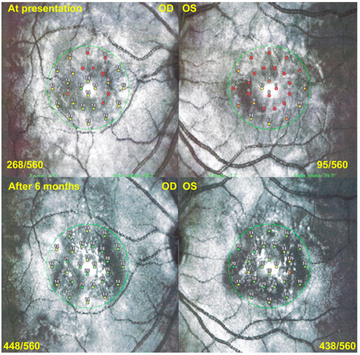 Figure 13