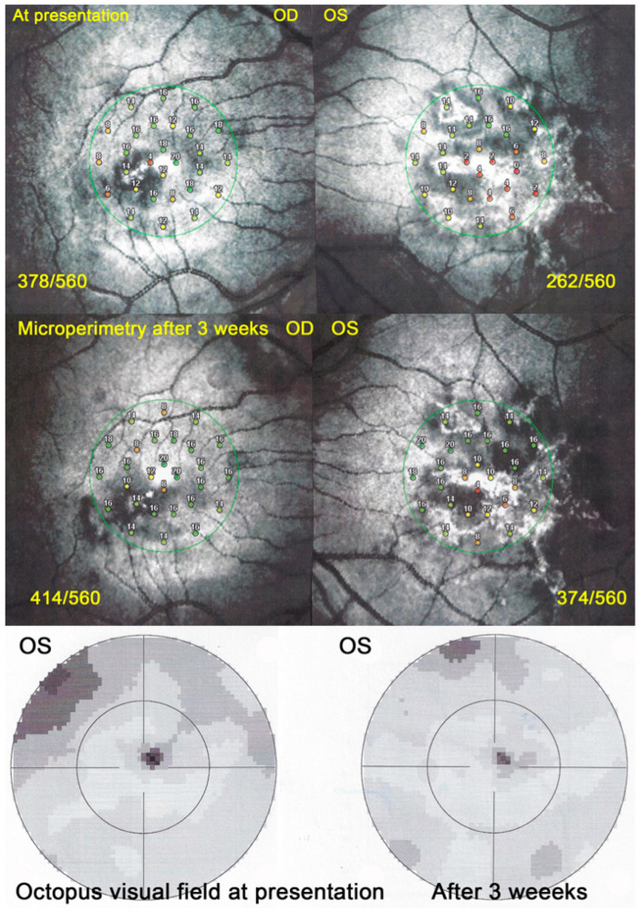 Figure 26