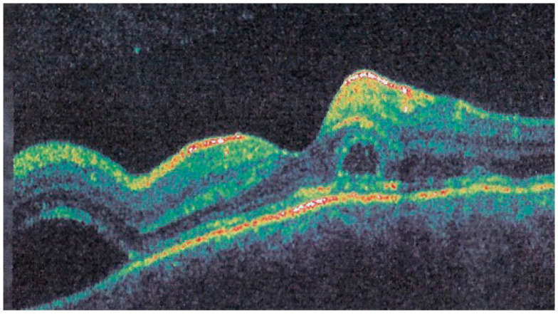 Figure 14