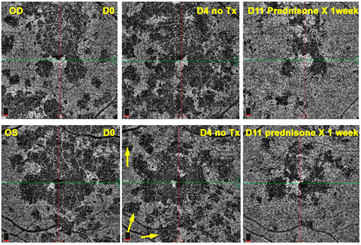 Figure 16