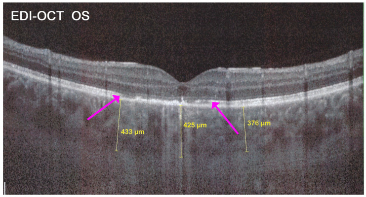 Figure 25