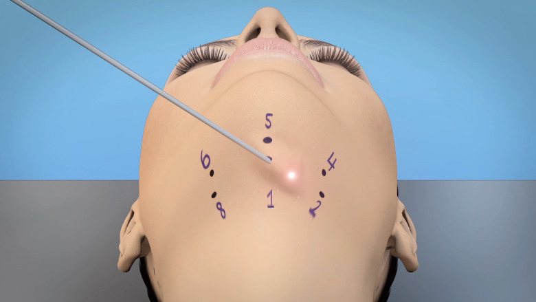 Figure 4.