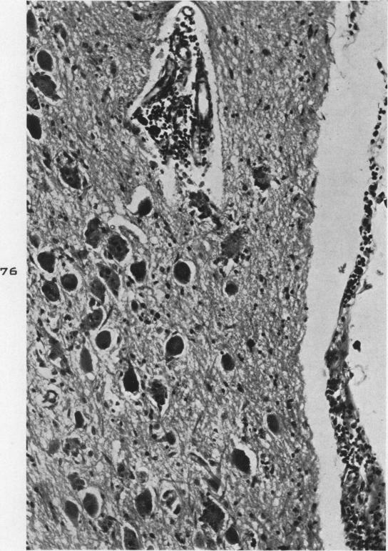 Fig. 76