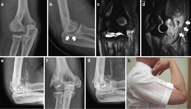 Fig. 3