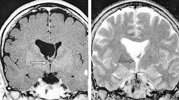 Fig 2.