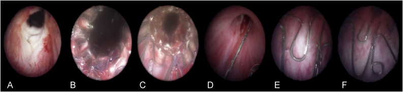 Fig. 1