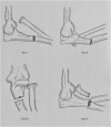 Fig. 11