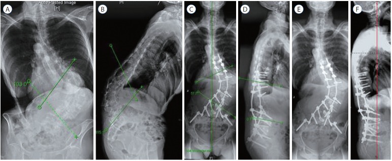 Fig. 4