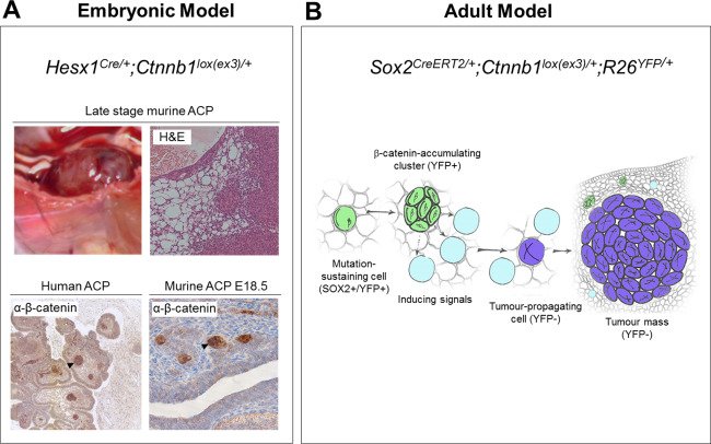 Genetically engineered mouse models of craniopharyngioma: an ...