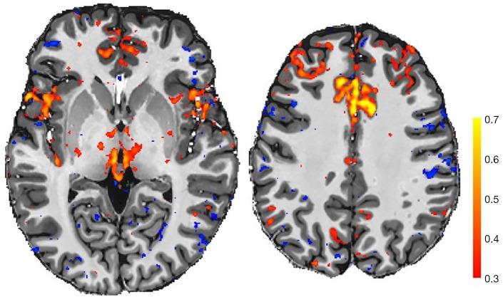 Figure 11