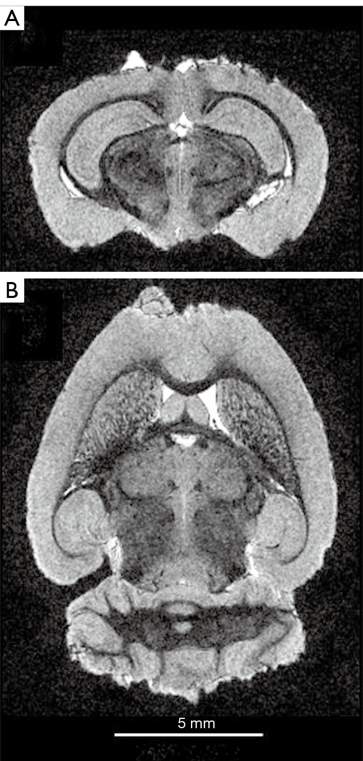 Figure 17