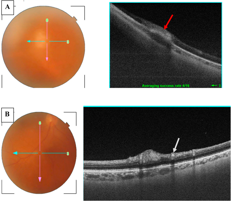 Fig. 3