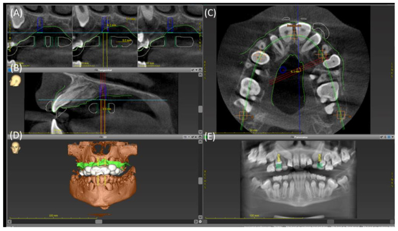 Figure 2
