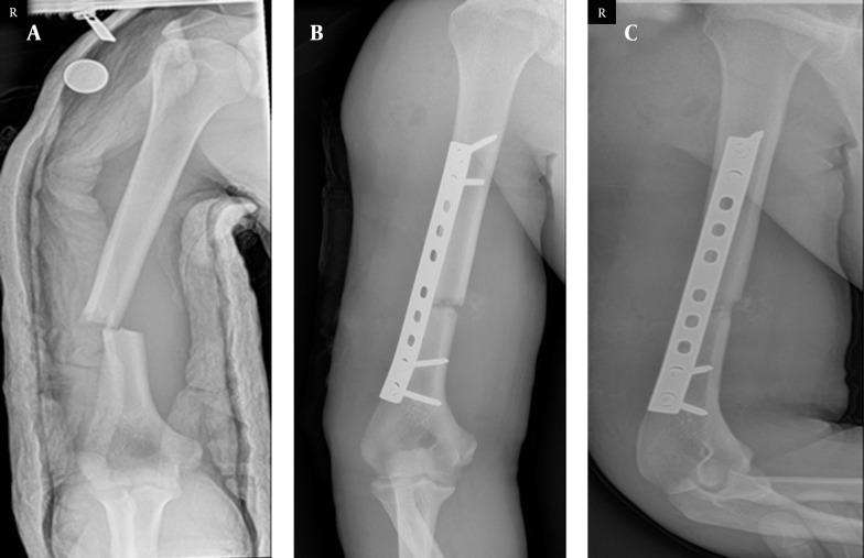 Figure 4.