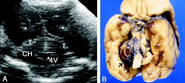 Fig 15.