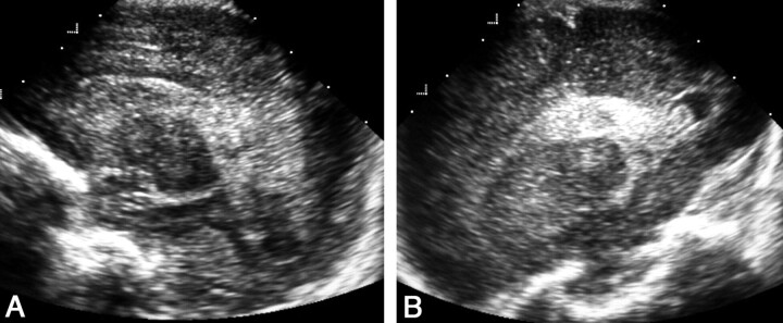 Fig 16.