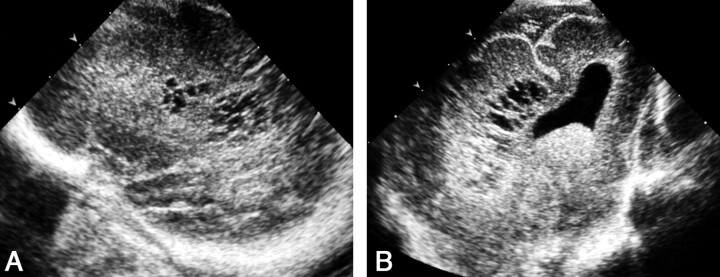 Fig 14.