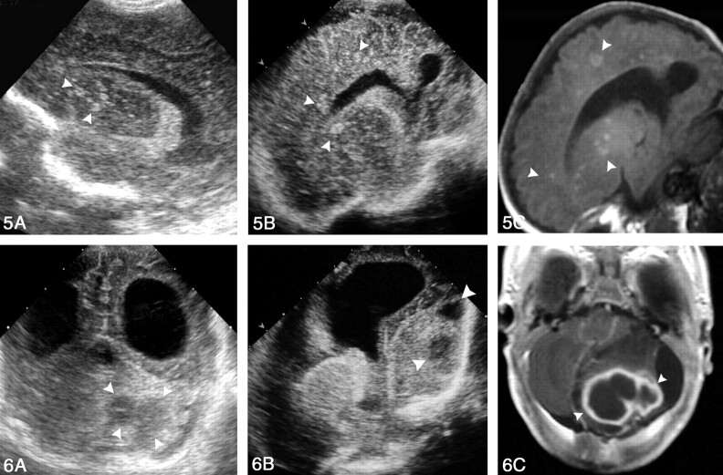 Fig 5.