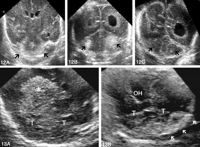 Fig 12.