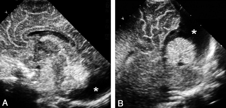 Fig 4.