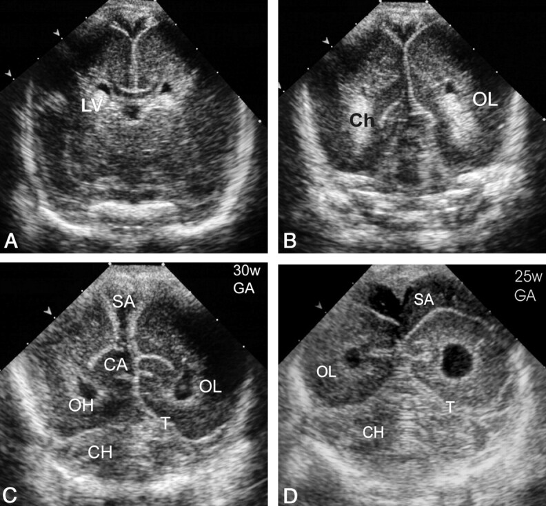 Fig 2.