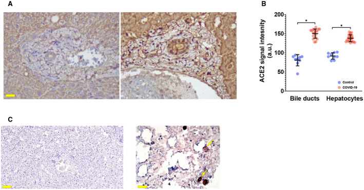 FIG. 3