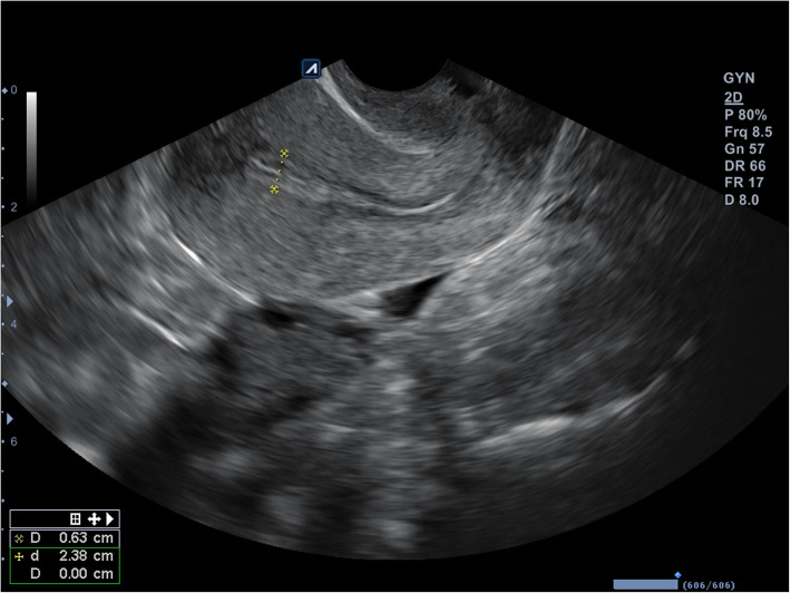 Fig. 5