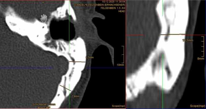 Fig. 3