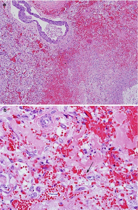 Fig. 17.6