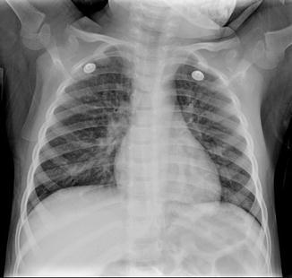 Fig. 17.1