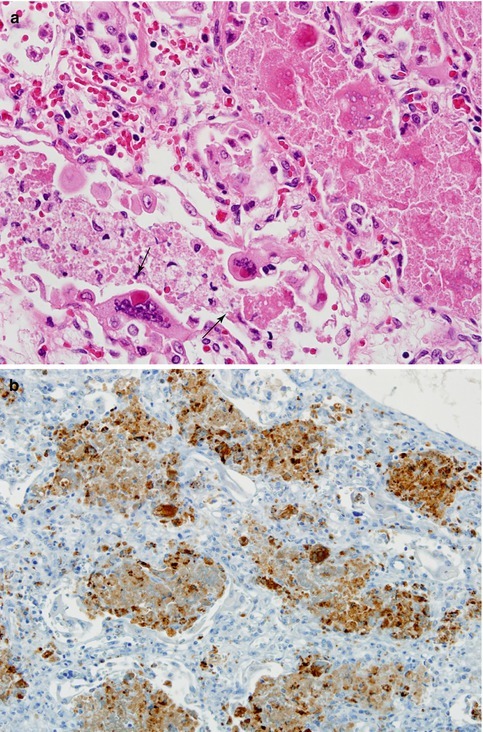 Fig. 17.3