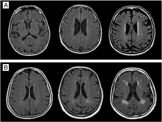 Fig. 1