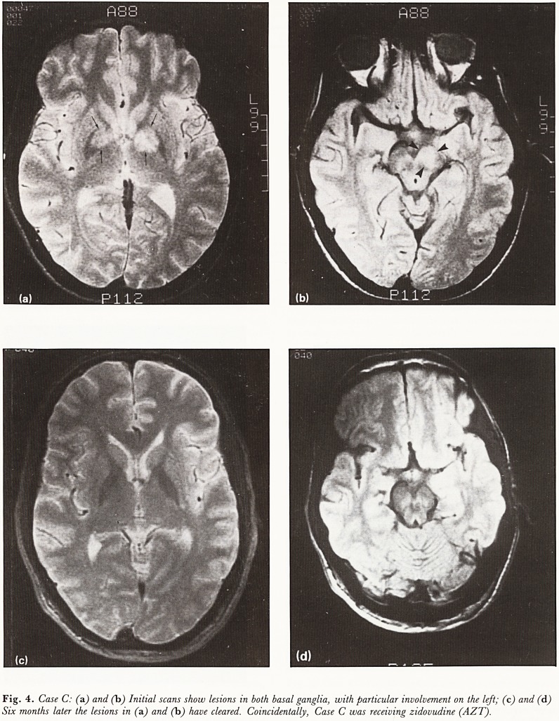 Fig. 4. Case C: