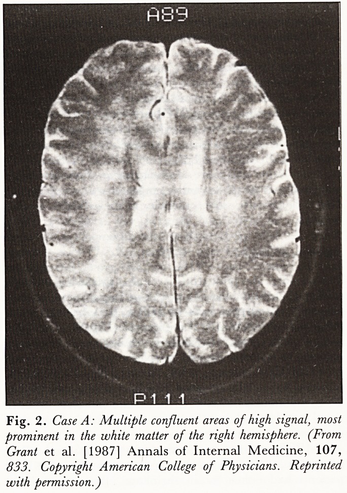 Fig. 2. Case A: