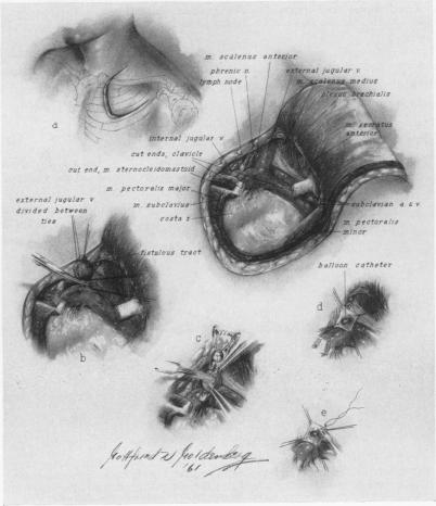 Fig. 4a.