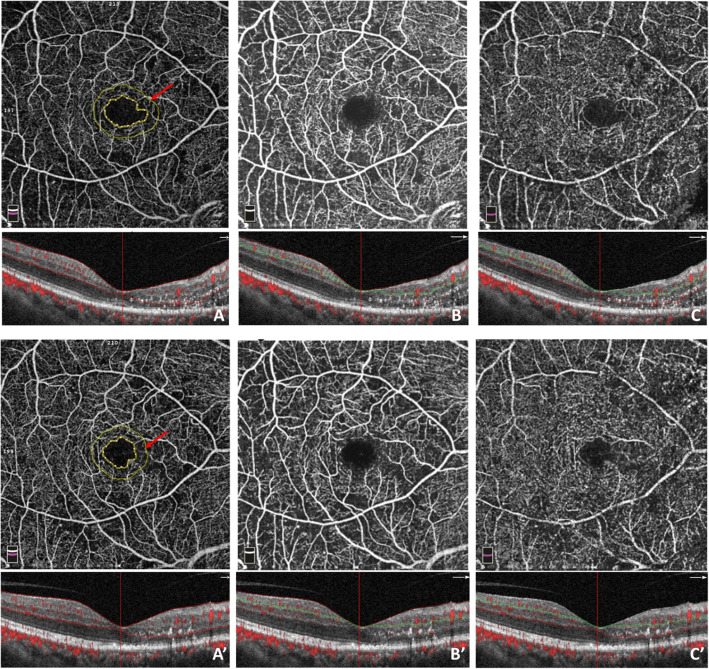 Fig. 2