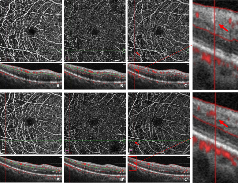 Fig. 4