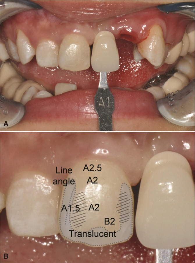 Fig. 5