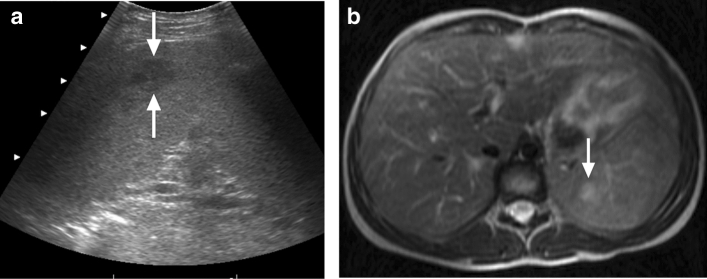 Fig. 12