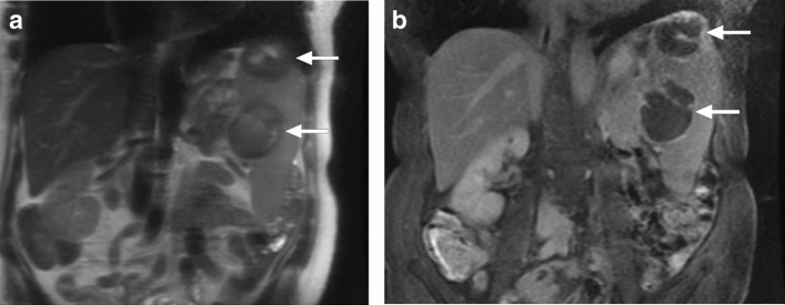 Fig. 20