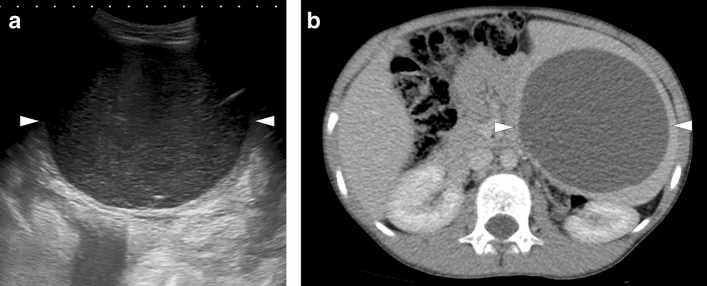 Fig. 31