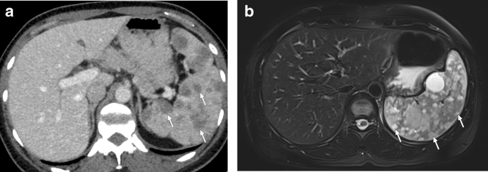 Fig. 27