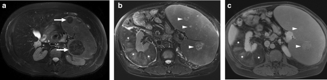 Fig. 34