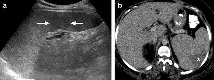 Fig. 4