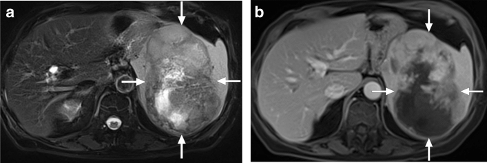 Fig. 10