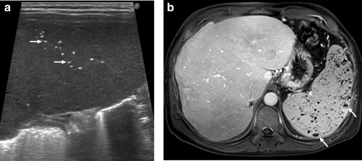 Fig. 30